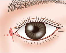 手順03：ロール状にします。